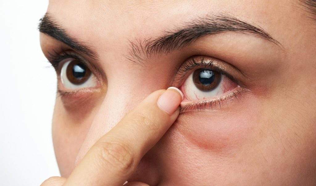 женский болезни глаза